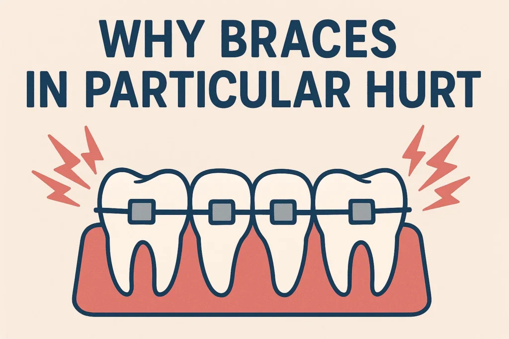 Do Braces Hurt? Understanding why braces cause discomfort