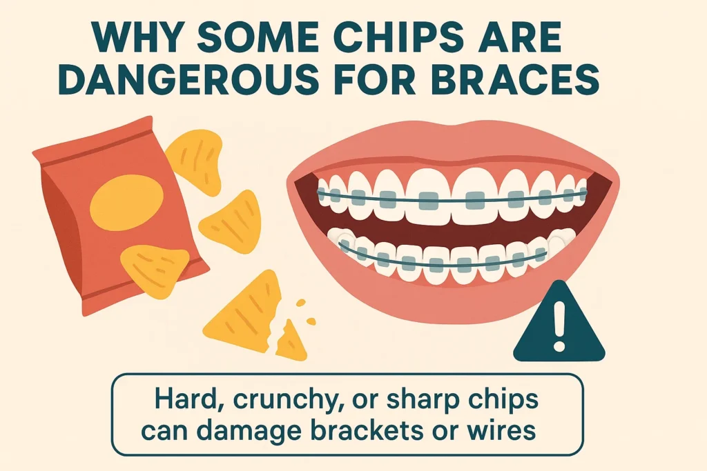 Can I eat chips with braces? Learn why some chips can be harmful to your braces.