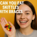 Can You Eat Skittles with Braces