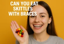 Can You Eat Skittles with Braces