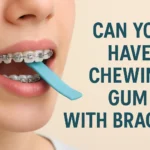 Can You Have Chewing Gum with Braces