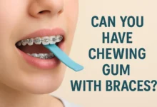 Can You Have Chewing Gum with Braces