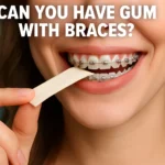 Can You Have Gum with Braces