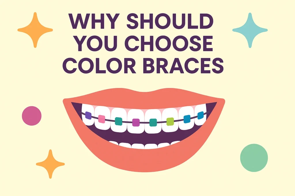 Color Braces Colors – Reasons to choose color braces and how they allow for personalized orthodontic treatment.