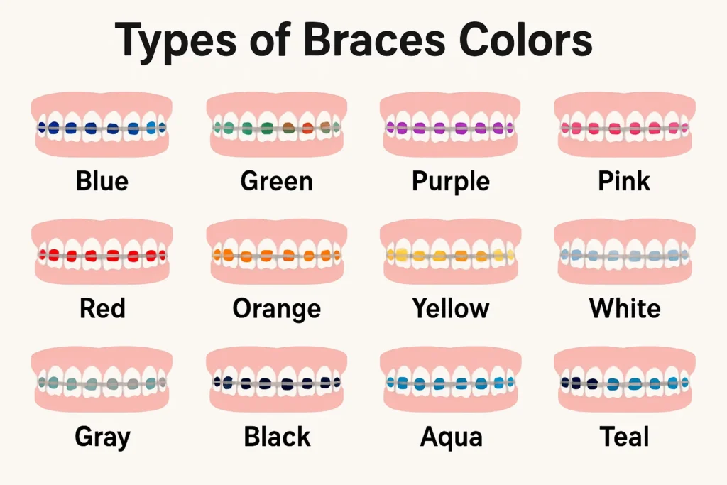 Color Braces Colors – Explore the various types of braces colors available to suit your style and personality.