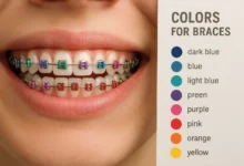 Colors for Braces