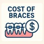 Cost of Braces