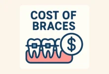 Cost of Braces