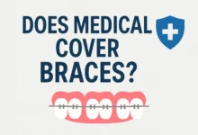 Does Medical Cover Braces