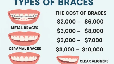 How Much Do Braces Cost