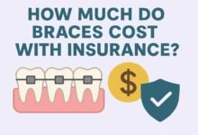 How Much Do Braces Cost With Insurance