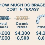 How Much Do Braces Cost in Texas: Cost of braces in Texas