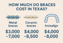 How Much Do Braces Cost in Texas: Cost of braces in Texas