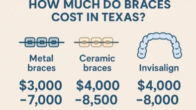 How Much Do Braces Cost in Texas: Cost of braces in Texas
