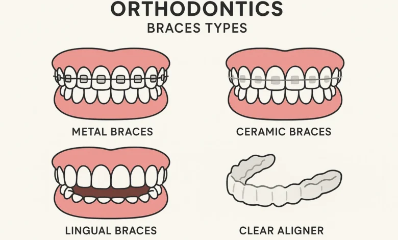 Orthodontics Braces Types