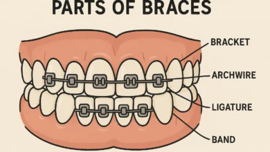 Parts of Braces