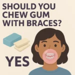 Should You Chew Gum with Braces