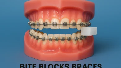 bite blocks braces