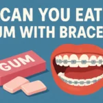 can you eat gum with braces