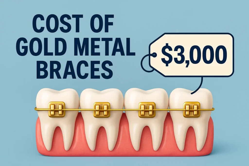 Gold Metal Braces – Understanding the cost of gold metal braces and what factors affect the price.
