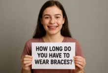 how long do you have to wear braces