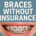 Braces without insurance can still be affordable with flexible payment plans and low-cost options