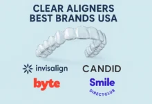 Clear aligners best brands USA compared with features, costs, and dentist recommendations for a straighter smile.