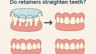 Explore how retainers work to straighten teeth and their role in maintaining orthodontic results.