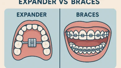 Expander vs Braces Difference – A comparison of orthodontic expanders and braces in terms of treatment, effectiveness, and purpose.