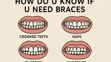 How Do U Know If U Need Braces explained with clear signs and expert guidance