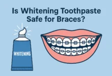 Is Whitening Toothpaste Safe for Braces with expert tips to maintain oral hygiene without damaging brackets or wires