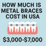 Image showing a detailed comparison of Metal Braces Cost in USA with average prices and payment options.