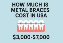 Image showing a detailed comparison of Metal Braces Cost in USA with average prices and payment options.