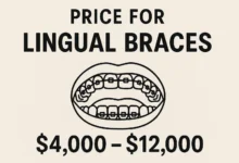 Price for Lingual Braces explained with complete cost details and factors influencing treatment