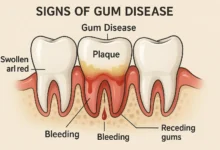 Signs of gum disease early stage including bleeding gums, bad breath, and sensitivity explained in detail.