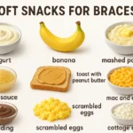 Soft Snacks for Braces explained with safe, tasty, and orthodontist-approved snack ideas