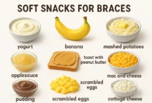 Soft Snacks for Braces explained with safe, tasty, and orthodontist-approved snack ideas