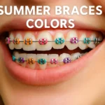 Summer Braces Colors make your smile bright and stylish with trendy shades for the season.