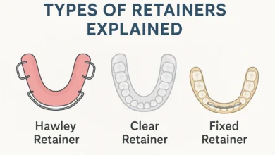 Types of Retainers Explained with clear details on fixed and removable options for orthodontic patients.
