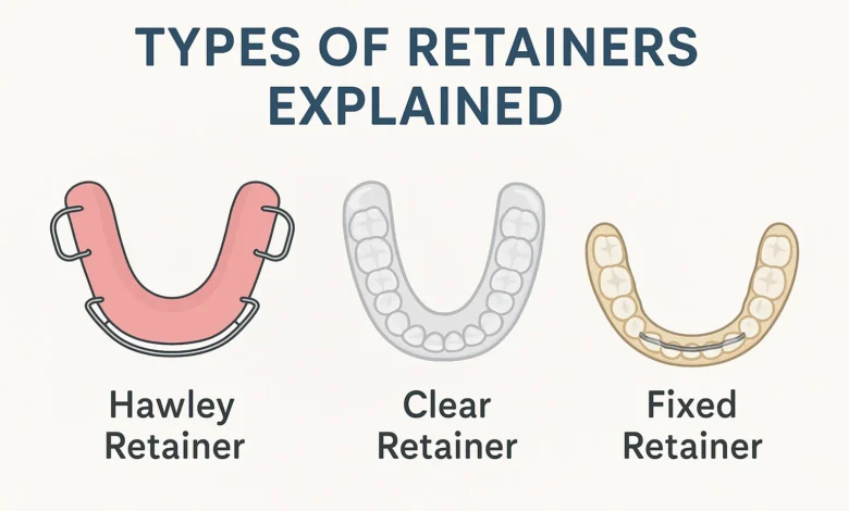 Types of Retainers Explained with clear details on fixed and removable options for orthodontic patients.