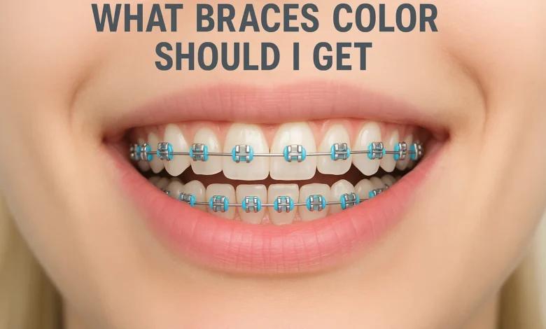 What Braces Color Should I Get is the most common question teens and adults ask when choosing the perfect shade for their smile