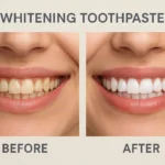 Before and after results of using whitening toothpaste to achieve a brighter smile