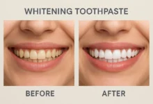 Before and after results of using whitening toothpaste to achieve a brighter smile