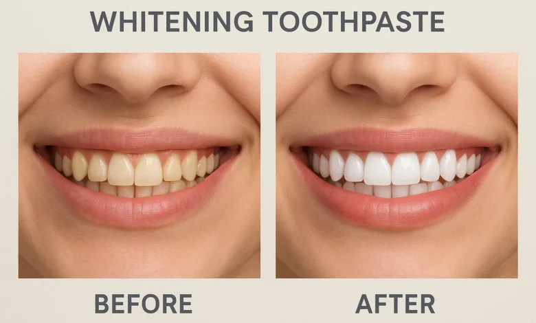 Before and after results of using whitening toothpaste to achieve a brighter smile