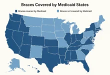 Braces Covered by Medicaid States explained in detail with updated coverage information