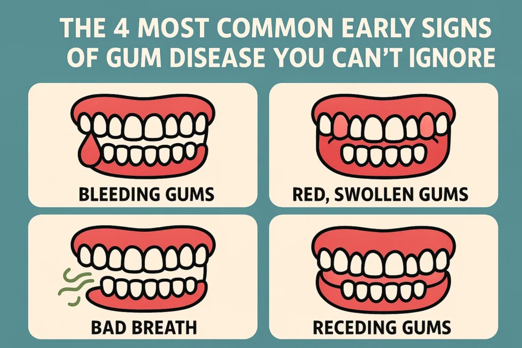 Early Signs of Gum Disease include symptoms like bleeding, swollen gums, and persistent bad breath that should not be ignored